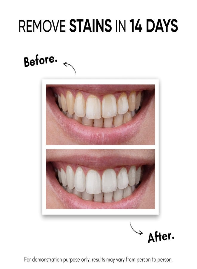 Masofta Teeth Whitening Pen For Removing Yellow and Dark Stains With PAP+, Peroxide & Sensitivity Free - 2ML - Image 5